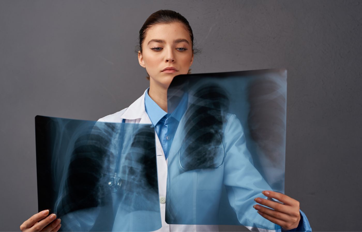 The Role of X-Rays